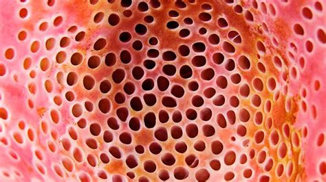 Fear Of Holes Trypophobia Eyes