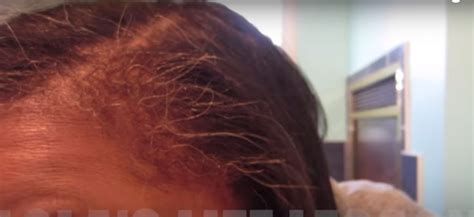 Blackstrap Molasses Grey Hair Reversal 6 Week Update ☕ Lolas Life