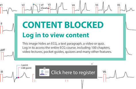 Ecg Leads Lead Placement Limb Chest Precordial Ecg Learning