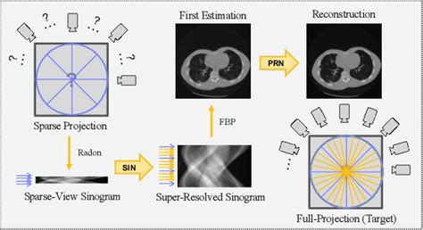 figure 1 from 2 step sparse view ct reconstruction with a domain specific perceptual network