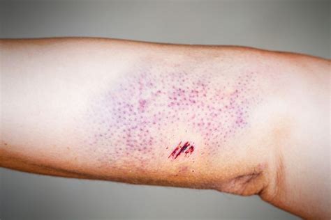 Red Spots On Skin Causes Diagnosis And Treatments