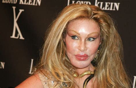 Who Is Jocelyn Wildenstein Catwoman Arrested For Clawing And