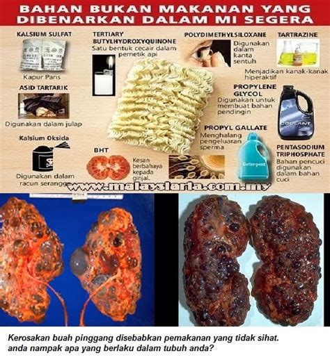 Ini kerana kebanyakan orang mengambil mi. Kesan Makan Maggi Pada Kesihatan. Maggi sangat beracun ...