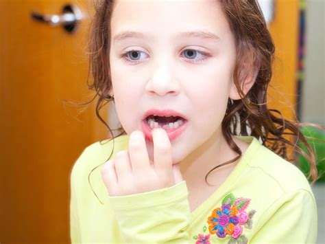 Here are some tips on how to pull a baby tooth out safely. Should I pull out a very loose tooth? | Loose tooth, Tooth ...