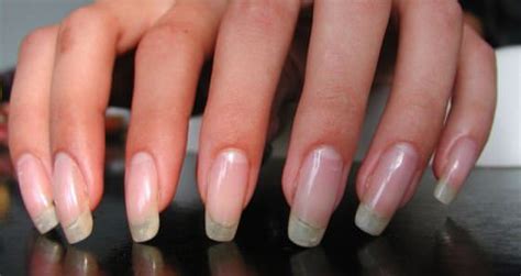 How To Grow Your Fingernails Fast