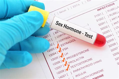 Postmenopausal Sex Hormone Levels Associated With Later Cvd The