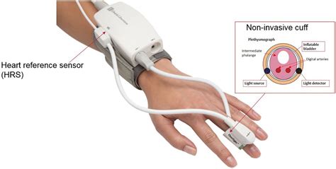 Continuous Noninvasive Arterial Pressure Monitoring For Transcatheter