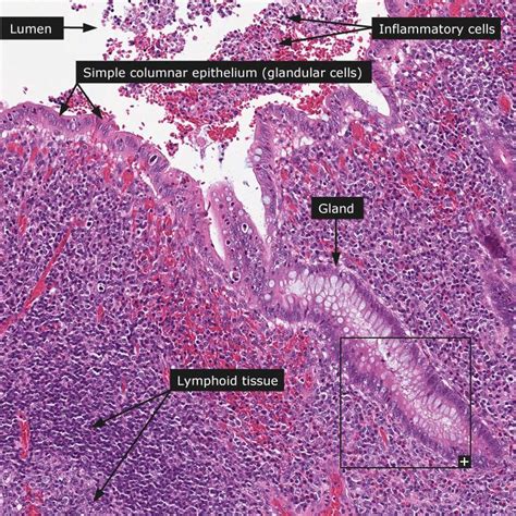 Normal Appendix 100x Insert 200x Histology Slides Protein