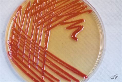 Serratia Marcescens Inoculated By Dr Ding Chuan Hun Muttaqillah