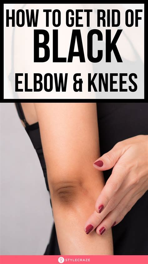 14 Home Remedies To Get Rid Of Black Knees And Elbow In 2020 Dark