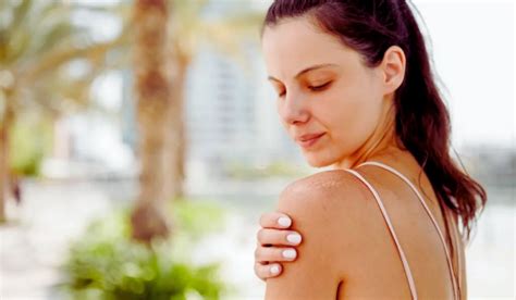 Common Cause Of Summertime Rashes How To Avoid Them