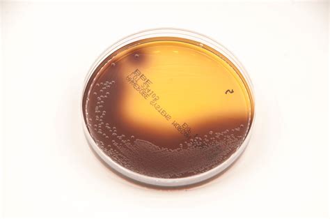 Bacteroides Bile Esculin Agar Bbe Anaerobe Systems