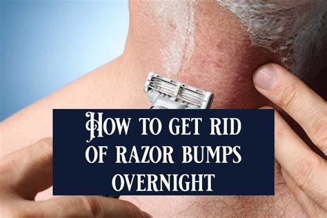 How To Get Rid Of Razor Bumps Fast Lmg For Health
