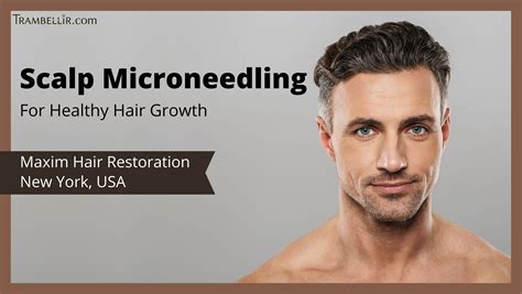 Top Microneedling For Hair Growth Eastonmainstreet