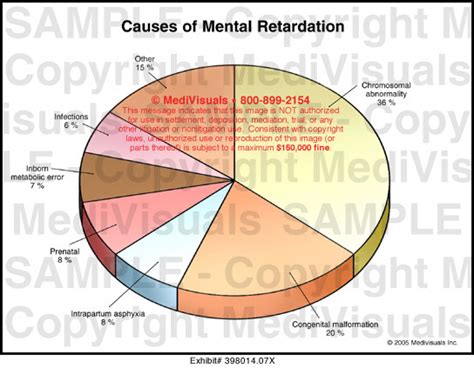 Causes Of Mental Retardation Medical Illustration Medivisuals