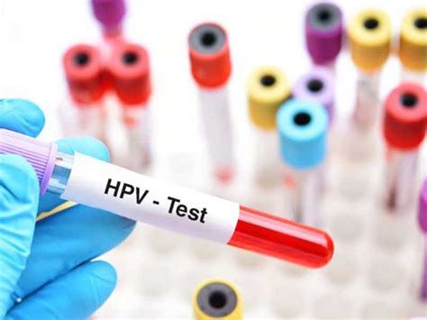 Hpv Testing On Skin Biopsy Virus Papiloma Humano Resumen Sexiz Pix