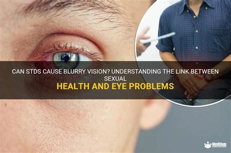 Can Stds Cause Blurry Vision Understanding The Link Between Sexual Health And Eye Problems