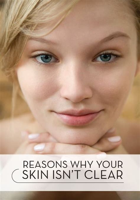 Reasons Why Your Skin Still Isnt Clear Yet Clear Skin Face Clear