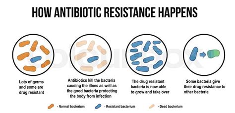 How Antibiotic Resistance Happens Diagram Vector Illustration For