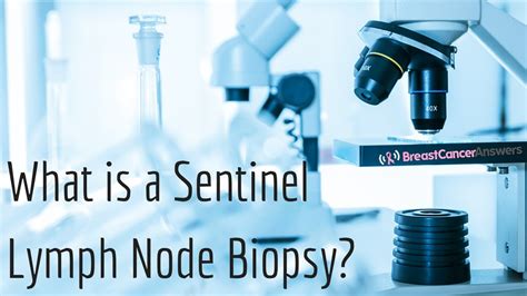 What Is A Sentinel Lymph Node Biopsy Youtube