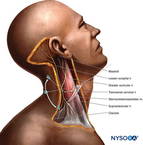 Cervical Plexus Block Landmarks And Nerve Stimulator Technique NYSORA