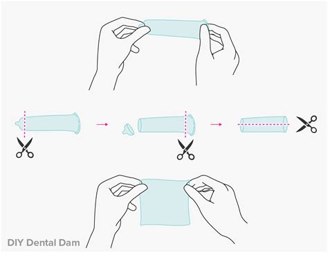 Learn about treatment for cell changes caused by hpv. What does diy mean sexually, THAIPOLICEPLUS.COM