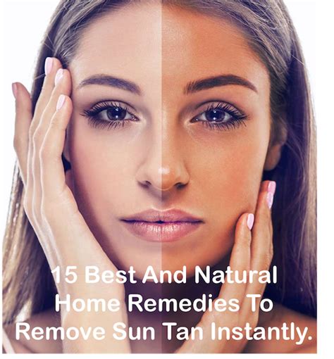 15 Best And Natural Home Remedi Es To Remove Sun Tan Instantly