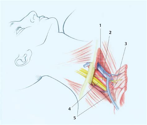 4 Supraclavicular And Infraclavicular Techniques Of Brachial Plexus
