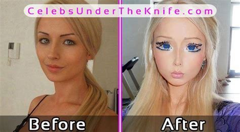 Valeria Lukyanova Barbie Plastic Surgery Before After Celebsundertheknife Celebs Celebrity
