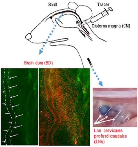 Dynamics Of Evans Blue Clearance From Cerebrospinal Fluid Into