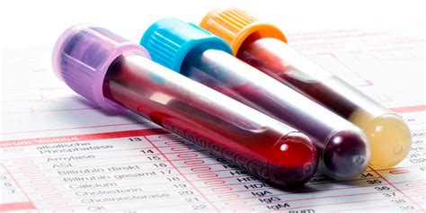 How To Interpret A Blood Analysis What You Need To Know【hsn Blog】