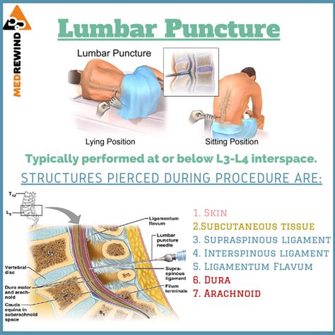 Lumbar Puncture Layers