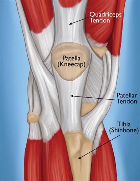 A ligament is a band of tissue that connects a bone to another bone. Quadriceps Tendon Tear - OrthoInfo - AAOS