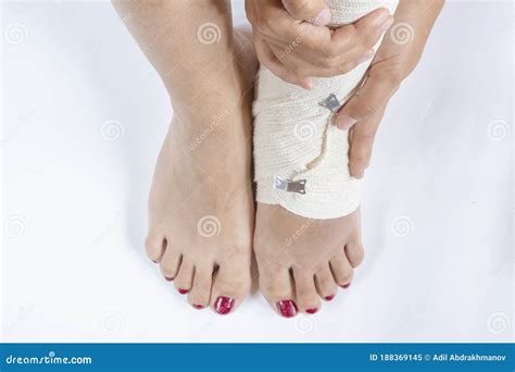 Twisted Bandaged Ankle With Bruise On White Background Athlete Runner
