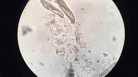 Microscope Euglena Paramecium Micropedia Free Hot Nude Porn Pic Gallery