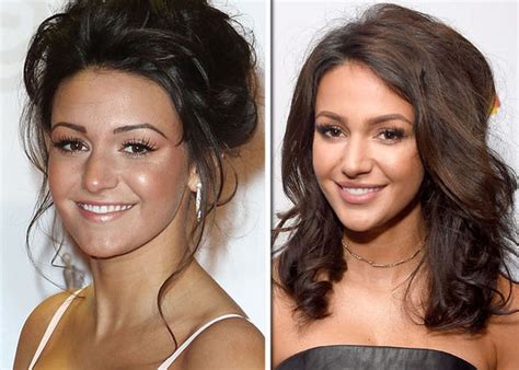 Has Michelle Keegan Had Plastic Surgery We Ask A Cosmetic Surgeon
