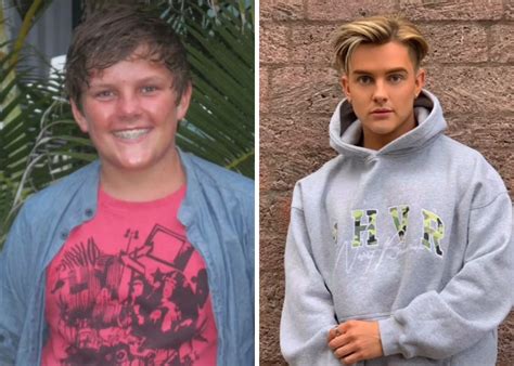 Before And After Puberty Before And After Puberty Glo