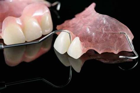 Tipos De Dentaduras Postizas Para Cada Necesidad Séptima Dental