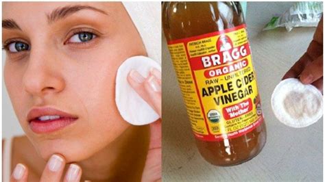 Manfaat cuka apel untuk wajah semakin banyak digunakan sebagai perawatan kulit secara natural. Tips Kecantikan: Cara Hilangkan Noda Hitam di Wajah ...