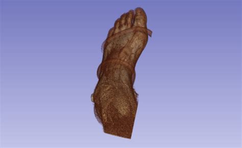 ◦ intrinsic muscles dominate the first and third layers. Foot MRI Inversion Internal Rotation Plantar Flexion ...
