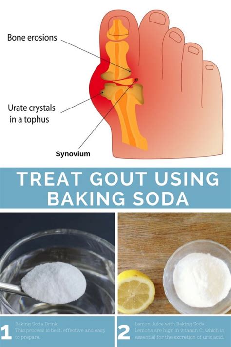 The water you drink and electrolytes you take are going into your body. How to Treat Gout using Baking Soda