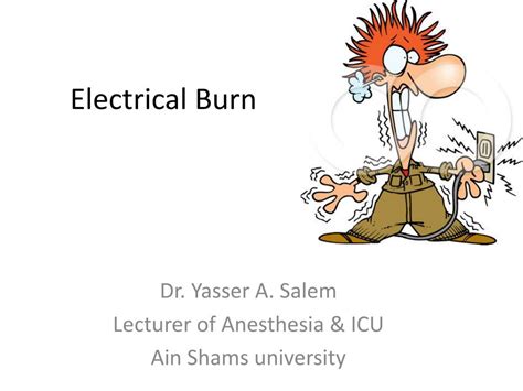 Ppt Electrical Burn Powerpoint Presentation Free Download Id1589876