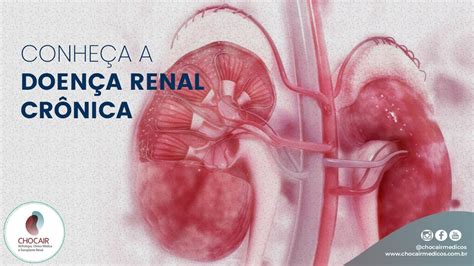 Doença Renal Em Estágio Final