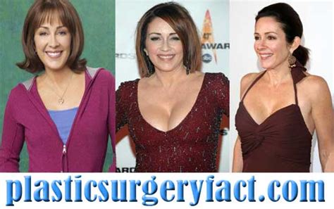 Patricia Heaton Plastic Surgery Before And After Plastic Surgery Facts