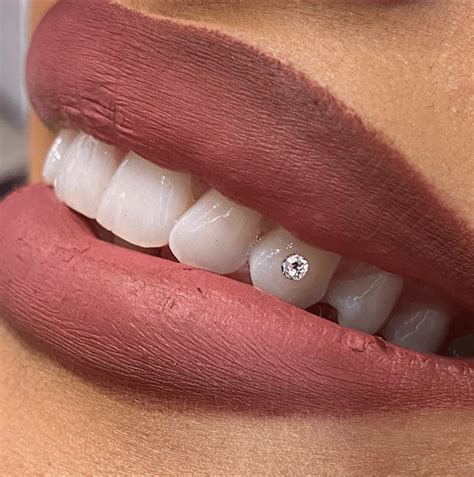 Tooth Gems Boujee Smile