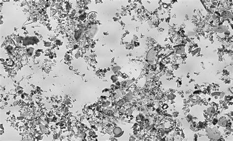 The end result of this combination is food grade diatomaceous earth is also safe for pets and livestock to consume for its natural i will get back to you if this sorts my problem as this is my last attempt at saving my plants. Diatoms - Plant Diversity (BOT317)