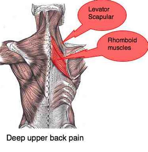 Injured ligaments heal faster when treated in a way to promote good blood flow. Healthool Scapular Pain (right, left) - Muscle pain Causes ...
