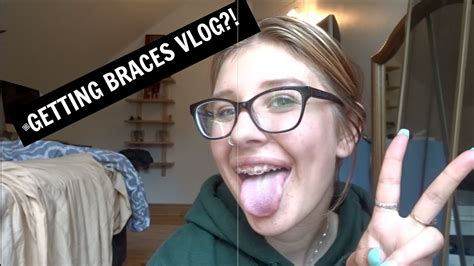 getting braces vlog youtube