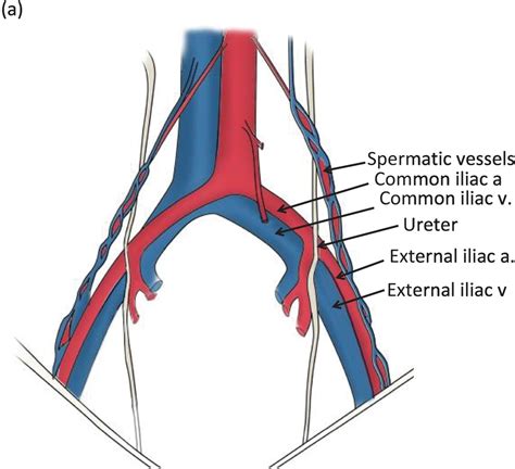 Common Iliac Vein Anatomy Function And Diagram Body M