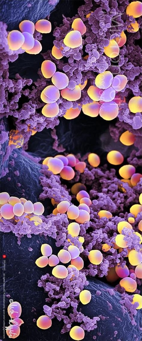 They are gram positive bacteria that are small round in shape (cocci) and occur as clusters appearing like a bunch of grapes on electron microscopy. Pin on Inspiring Things